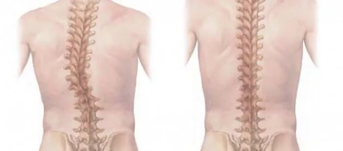 تعریف حرکت شناسی (کینزیولوژی) و اصلاح درمانی