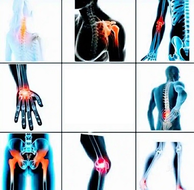 کاربردهای فیزیوتراپی و ارتوپدفنی در درمان ستون فقرات کمر و زانو